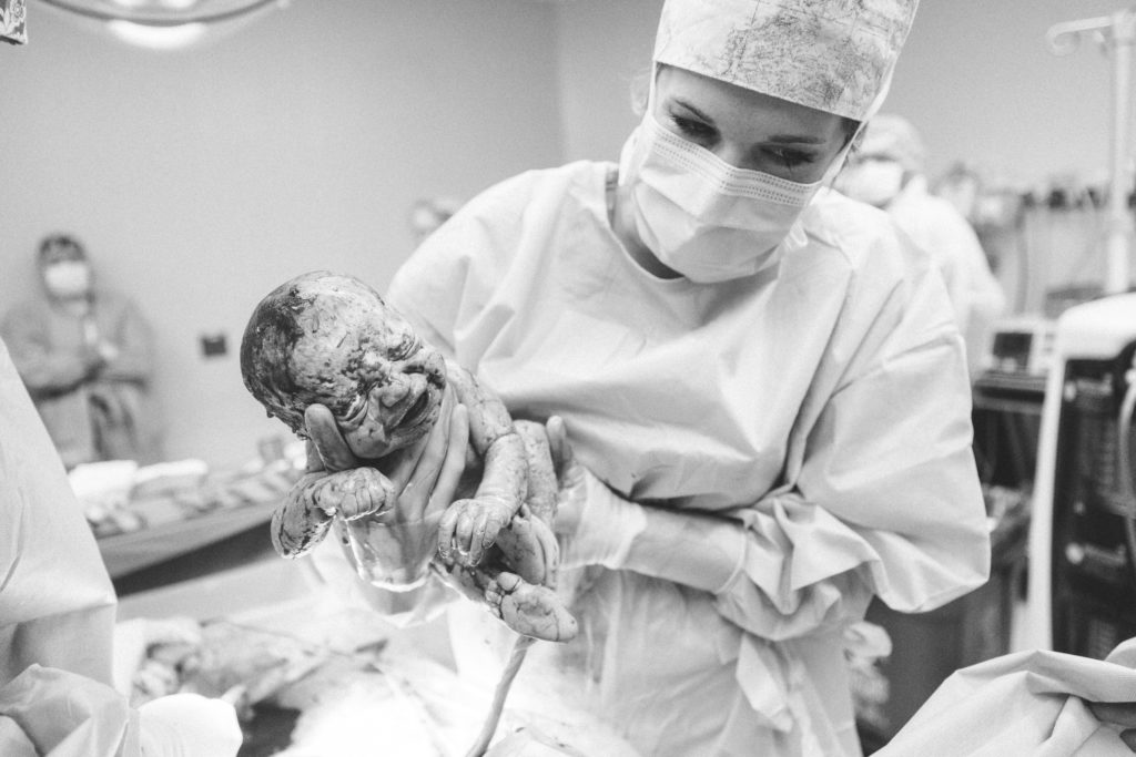 newborn baby from a c-section being held up by the doctor